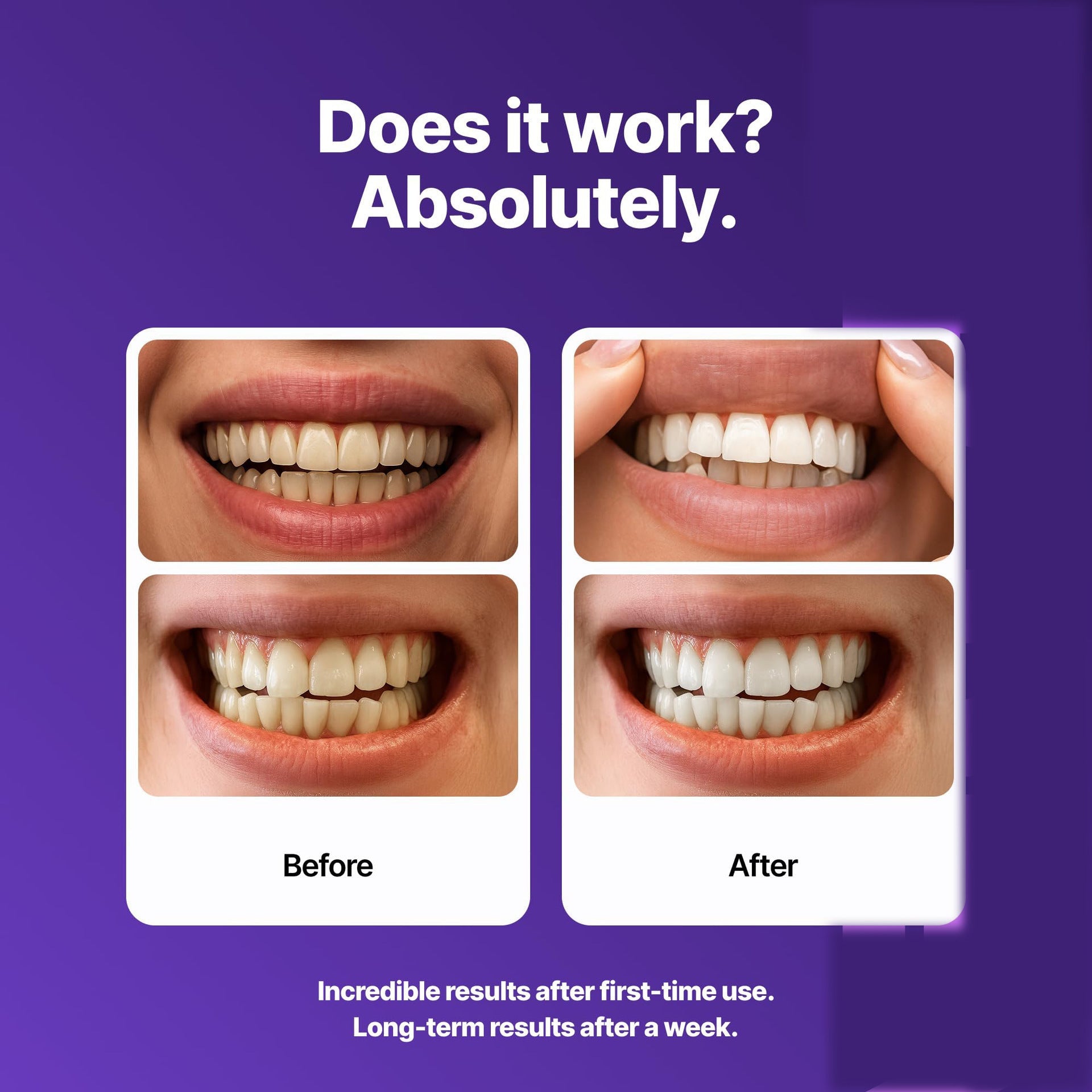 Dr Dent Purple Teeth Whitening Strips (42 Strips) - Ramixor